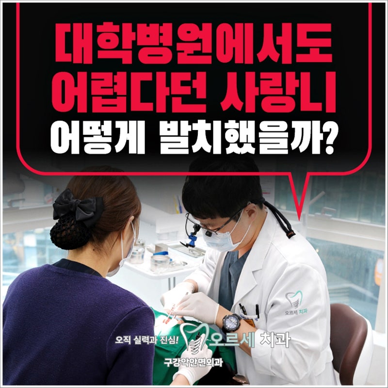 대학병원 가야 한다는 사랑니발치도 … 썸네일